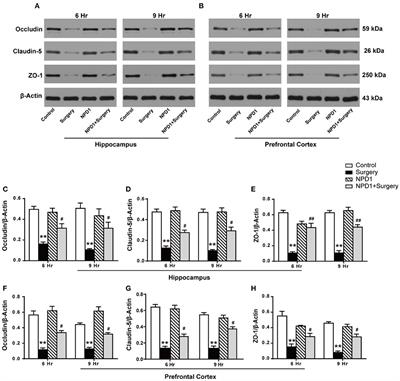 Corrigendum: Neuroprotectin D1 protects against postoperative delirium-like behavior in aged mice